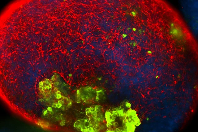 Stem cells