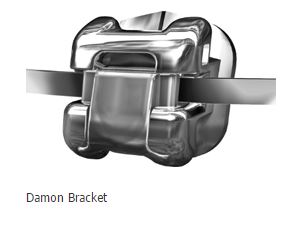 Damon metal