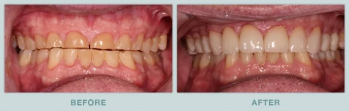 Frank_before_after.jpg