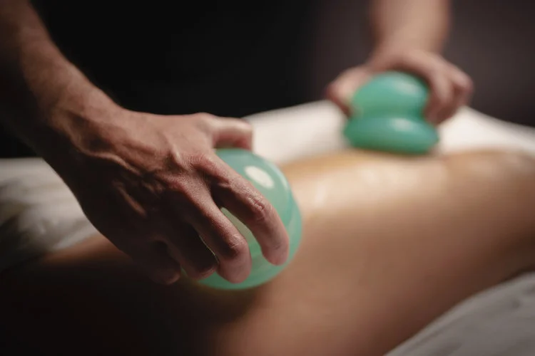 Cupping: History &amp; Benefits