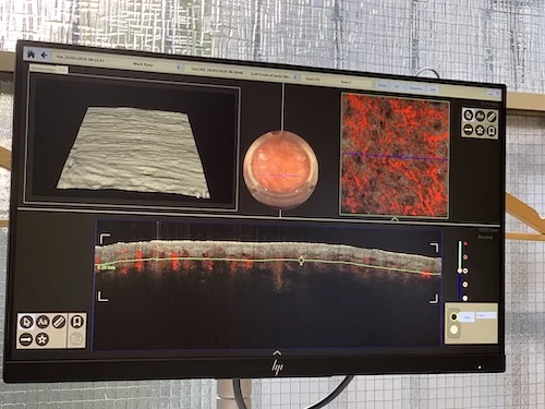 Skin Cancer Scanner - Sydney.jpeg