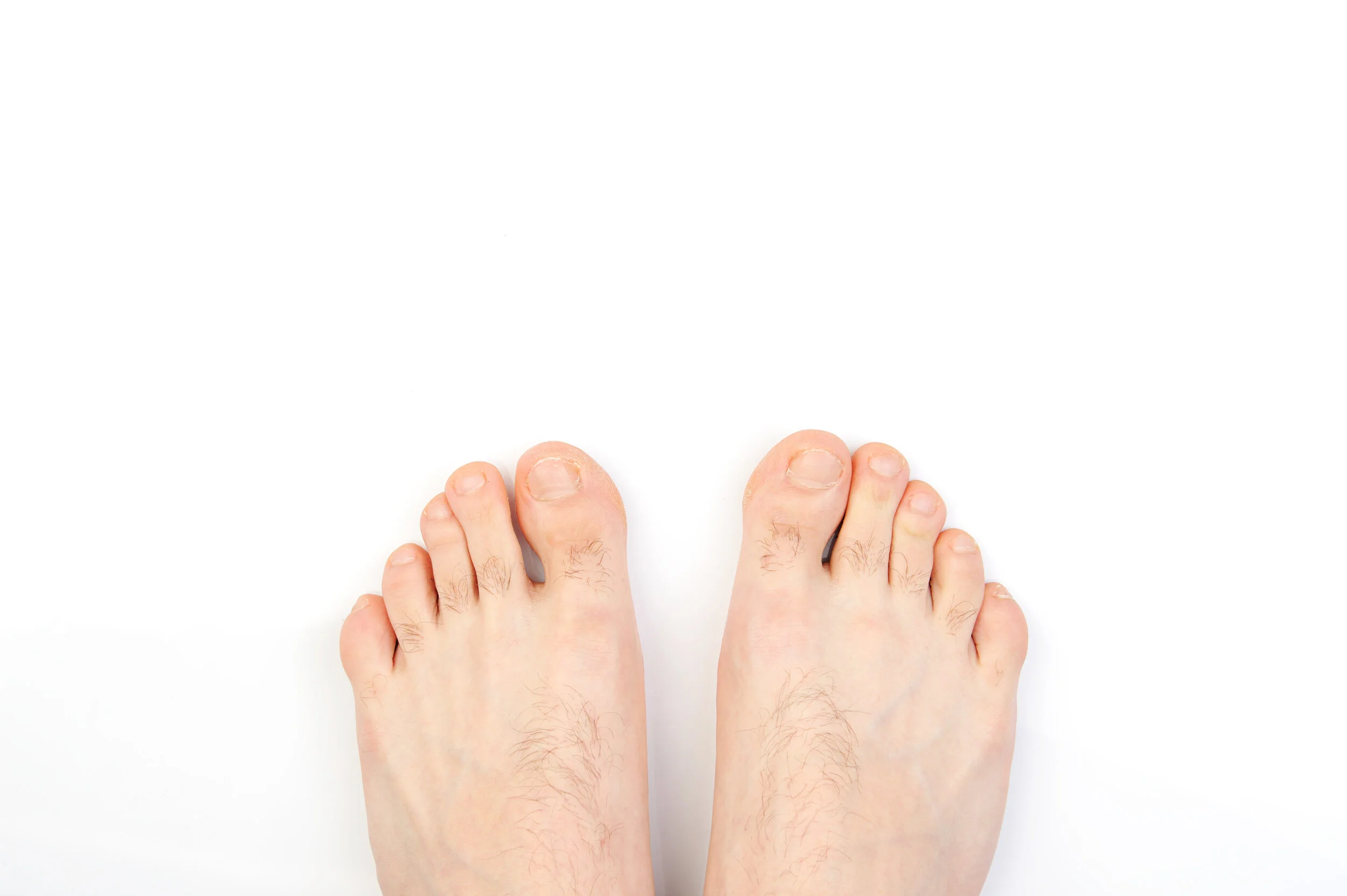 Top-down view of bare feet on white background showing fine hair on tops of feet and between toes