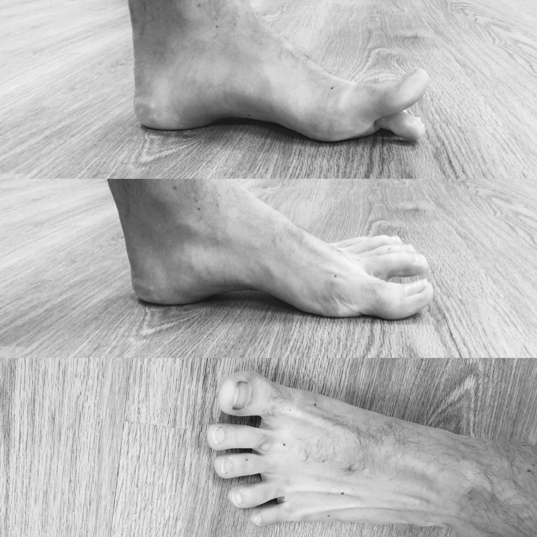 How To Treat Foot Pain With Easy Foot Strengthening Exercises — Evolve  Performance Healthcare, Molalla Chiropractor