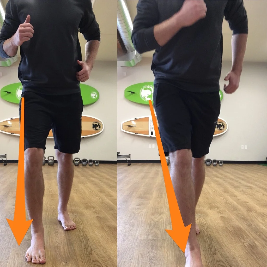 Knee Valgus.jpg