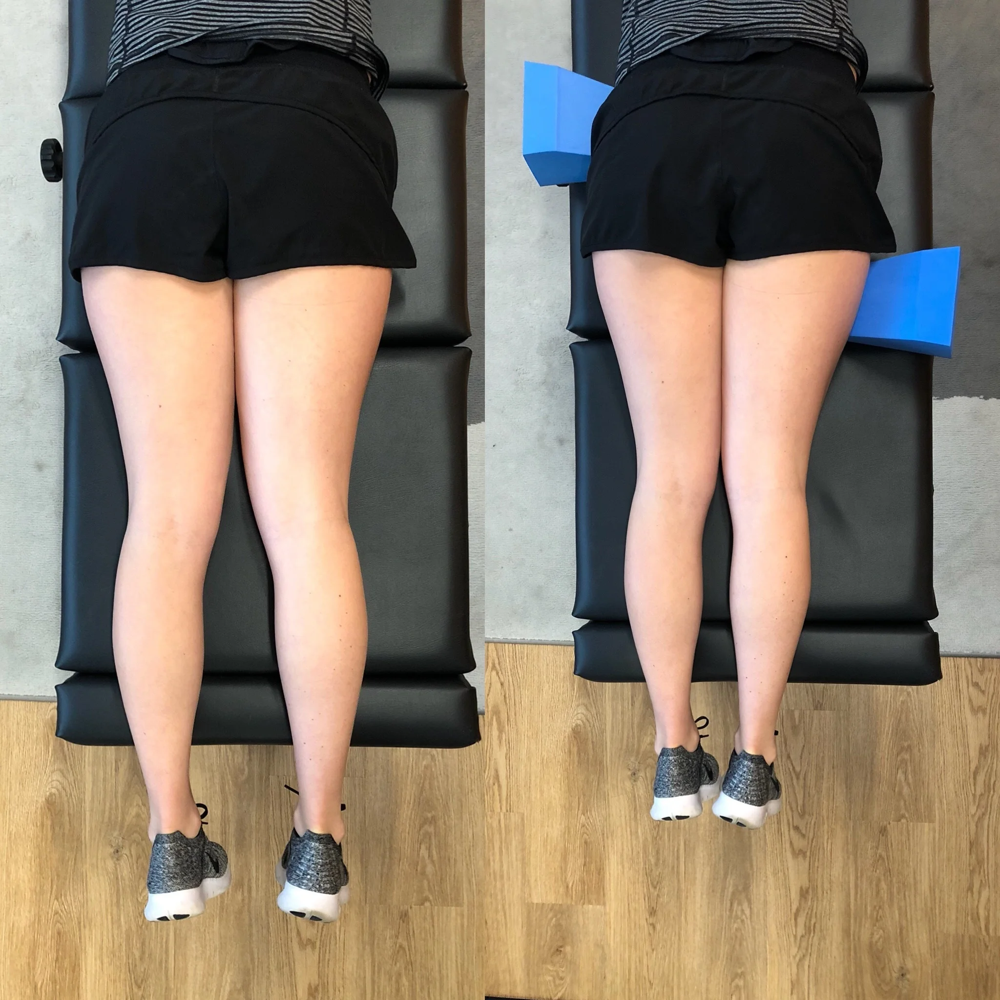 Correcting Leg Length Discrepancies.jpg
