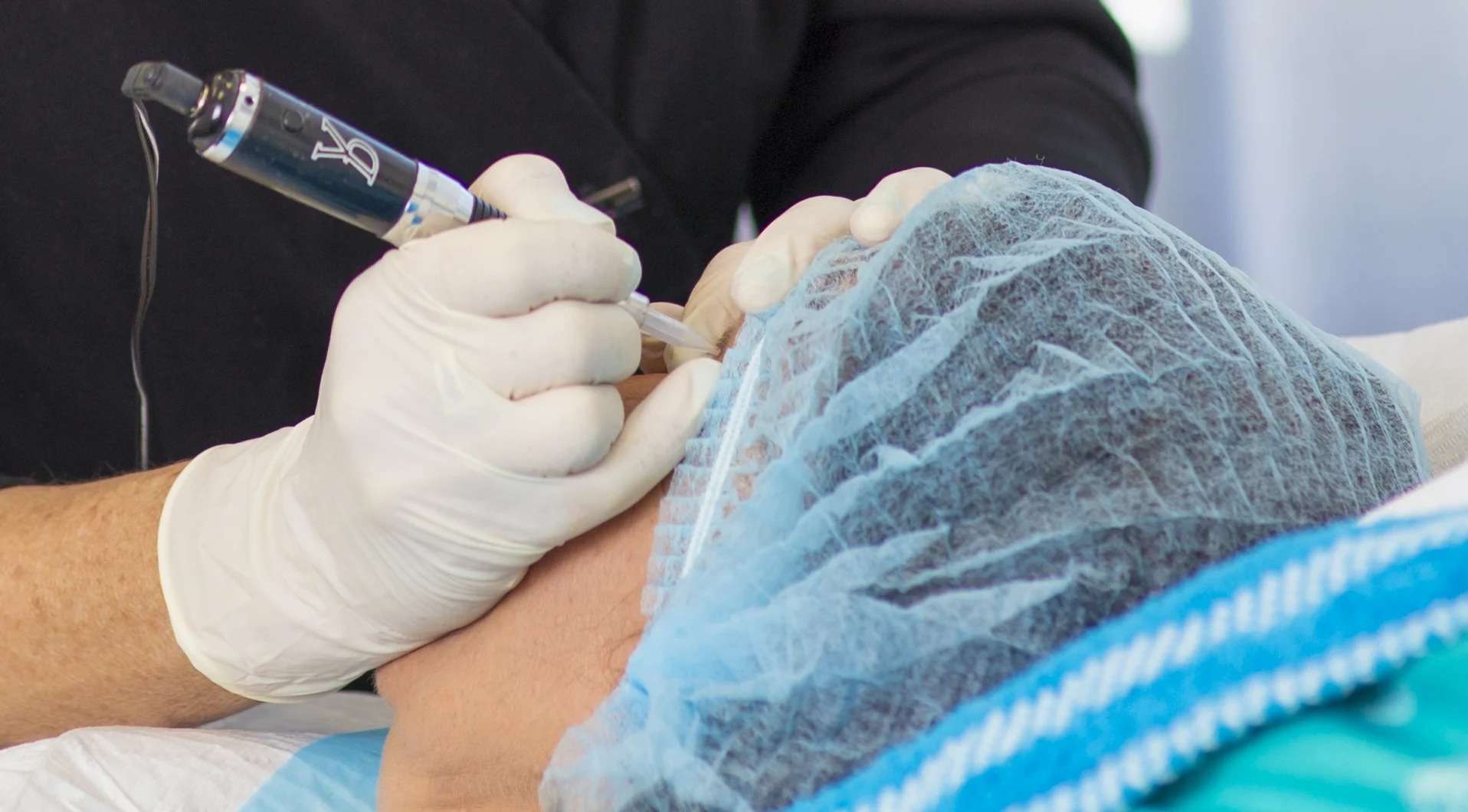 close up procedure.jpg