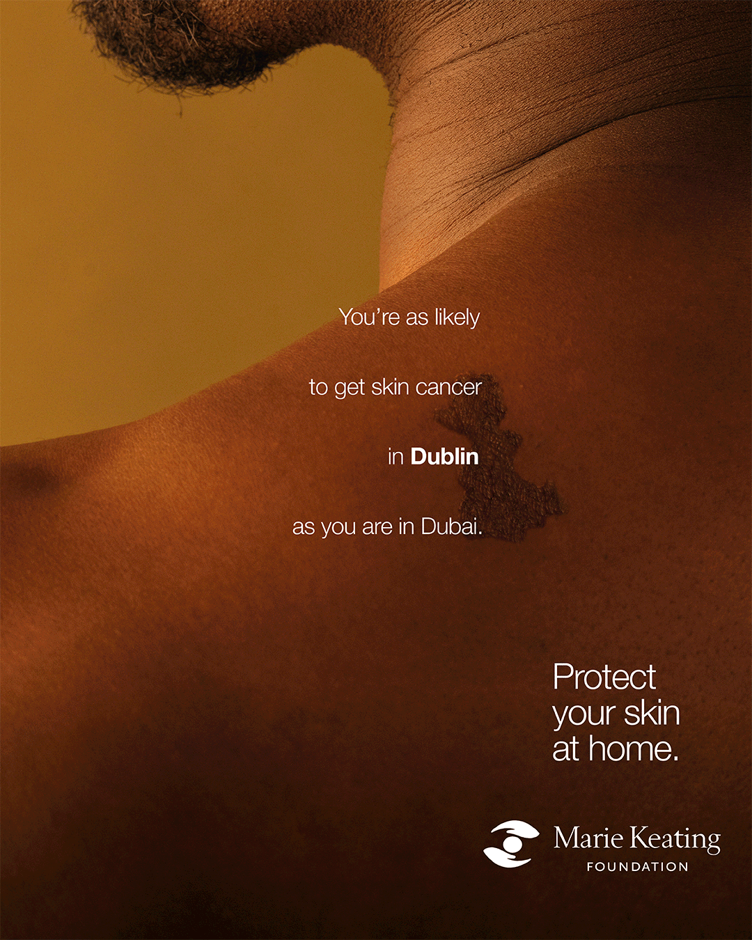 MKF_Skin_1080x1350.gif