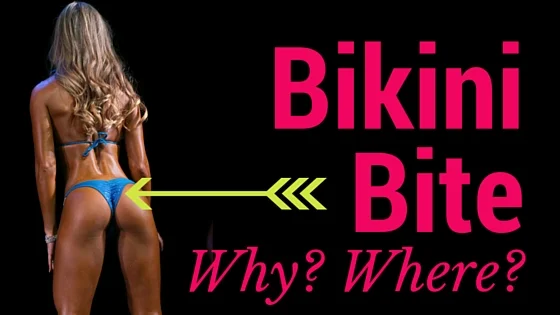Bikini Bite  - What you NEED to know!