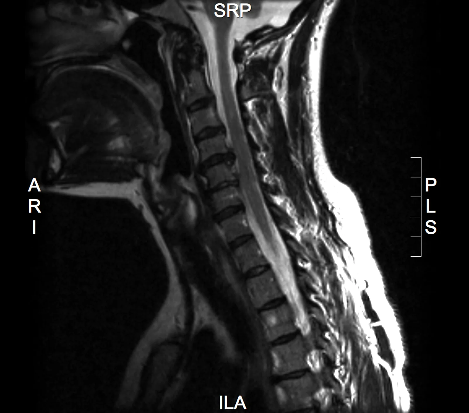 Do Not Fear MRI Results