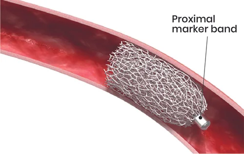 20190916_IMPEDE-FX in Vessel with Labels.jpg