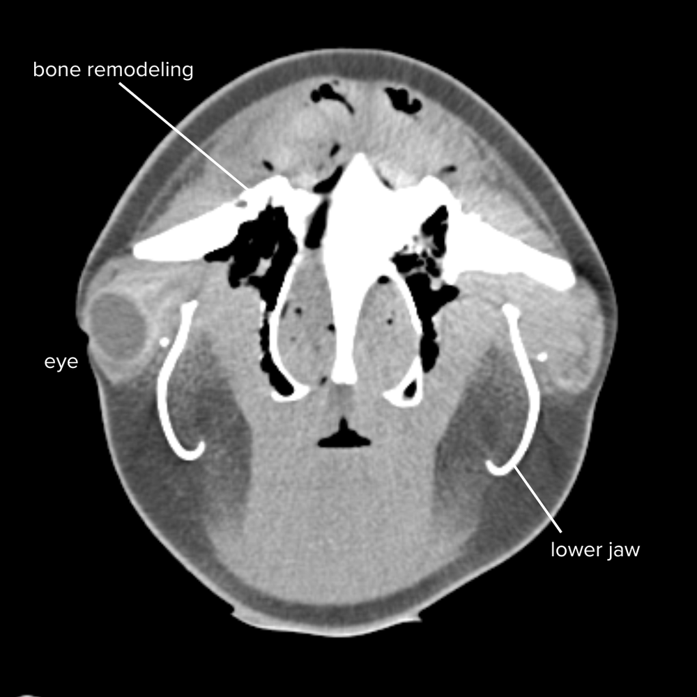   CT scan of the harbor porpoise’s skull and brain, showing bony remodeling of part of his skull.  