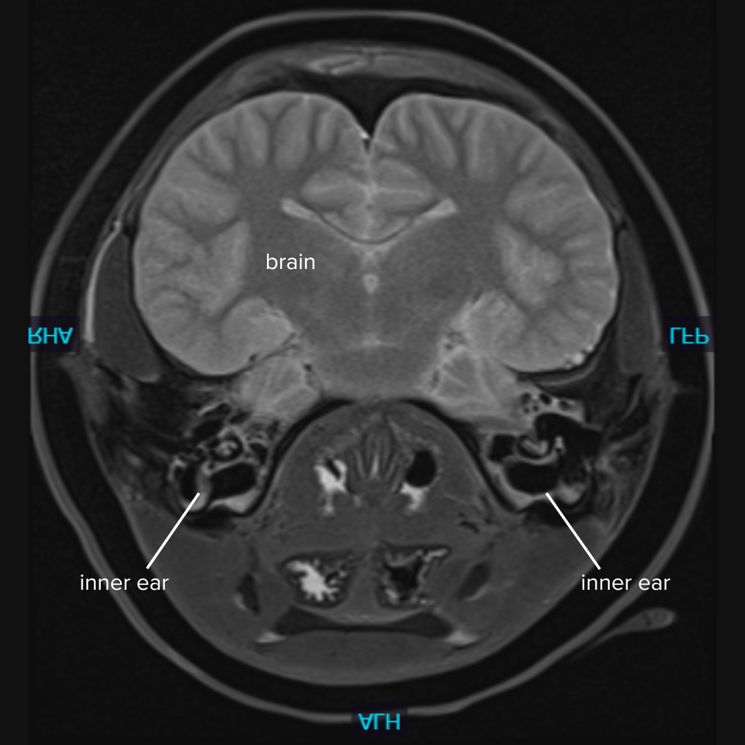   MRI of the harbor porpoise’s skull and brain, with the inner ears visible in the image.  