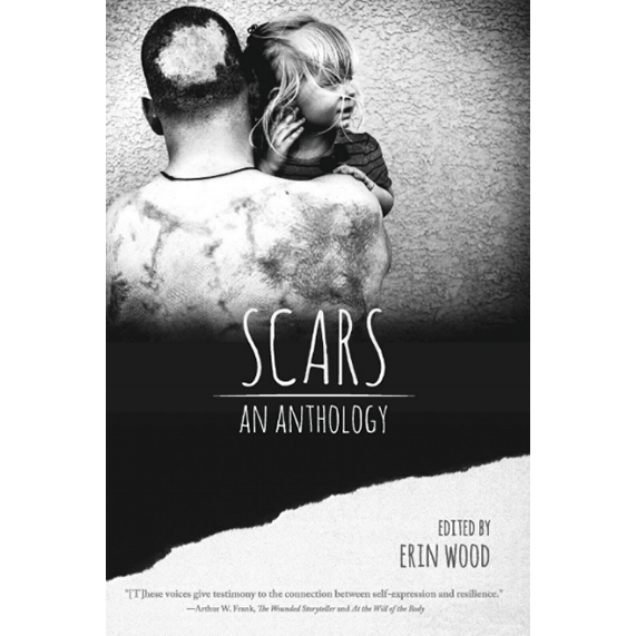 SCARS+FRONT+COVER+FOR+SITEAA.png