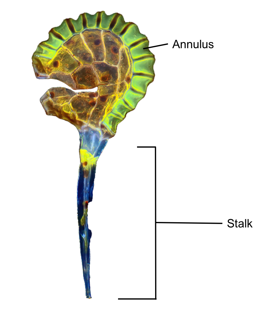 Figure 4. Individual sporangium with selective labeling. Courtesy of Rogelio Moreno .
