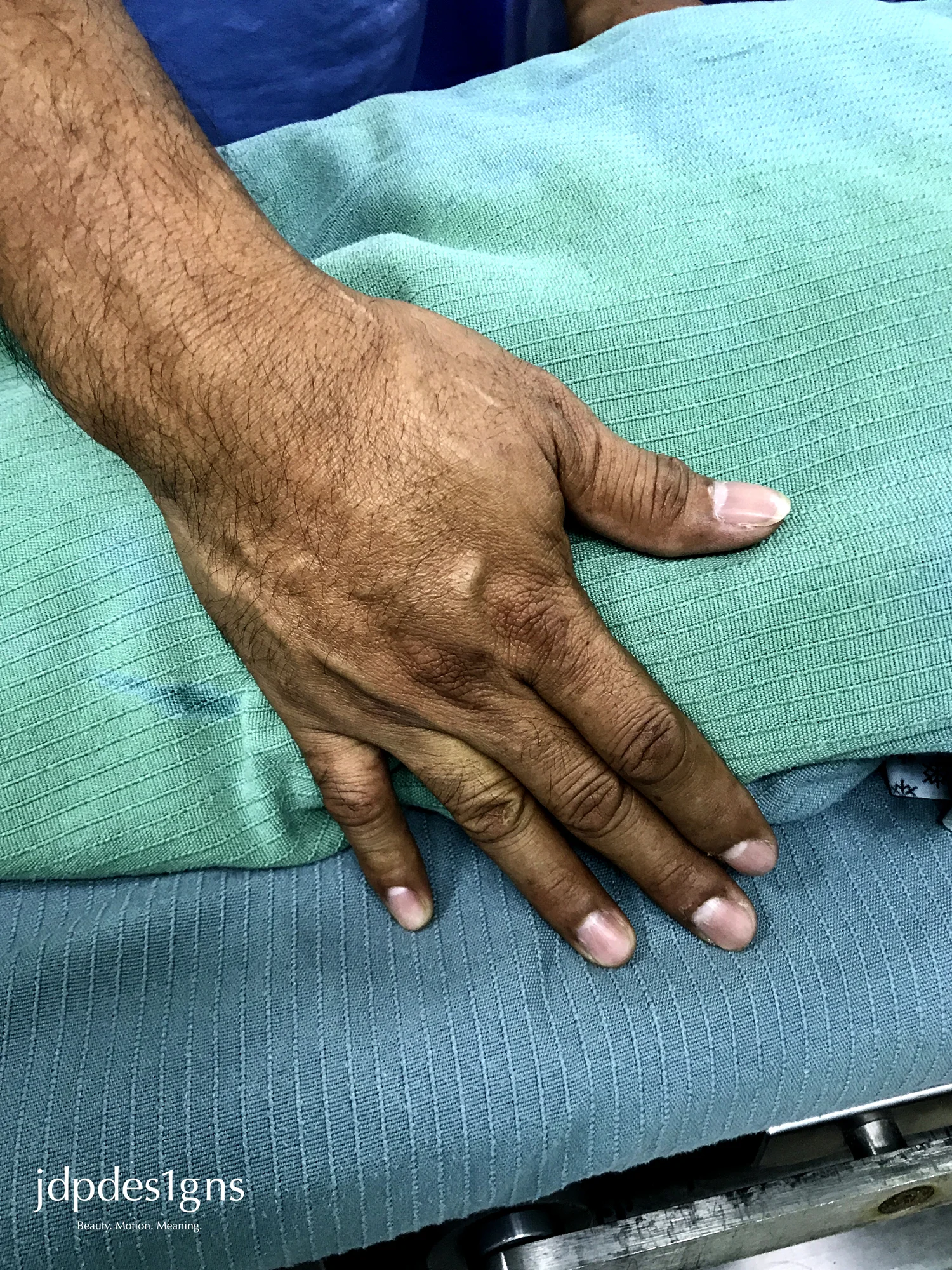 Nurse Hand Resize.jpg