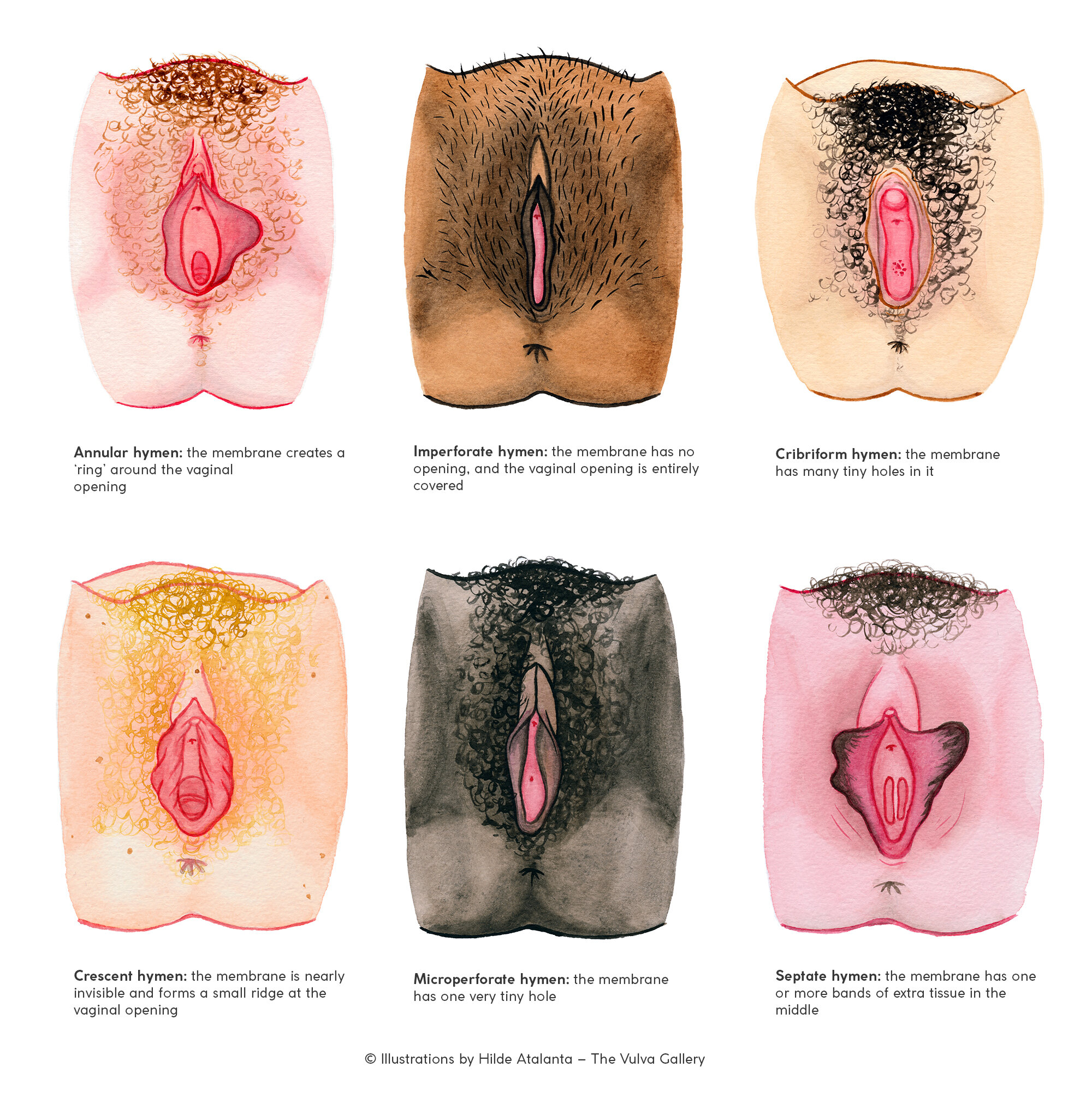 Pictures Of Different Types Of Pussy