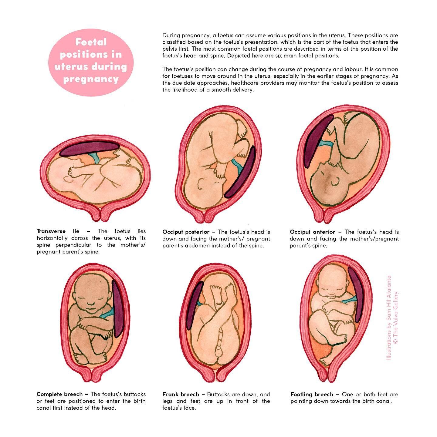 Let&rsquo;s talk about foetal positions! ✨ During pregnancy, a foetus can have all kinds of positions in the uterus. These positions are classified based on the part of the foetus that enters the pelvis first. The most common foetal positions are des