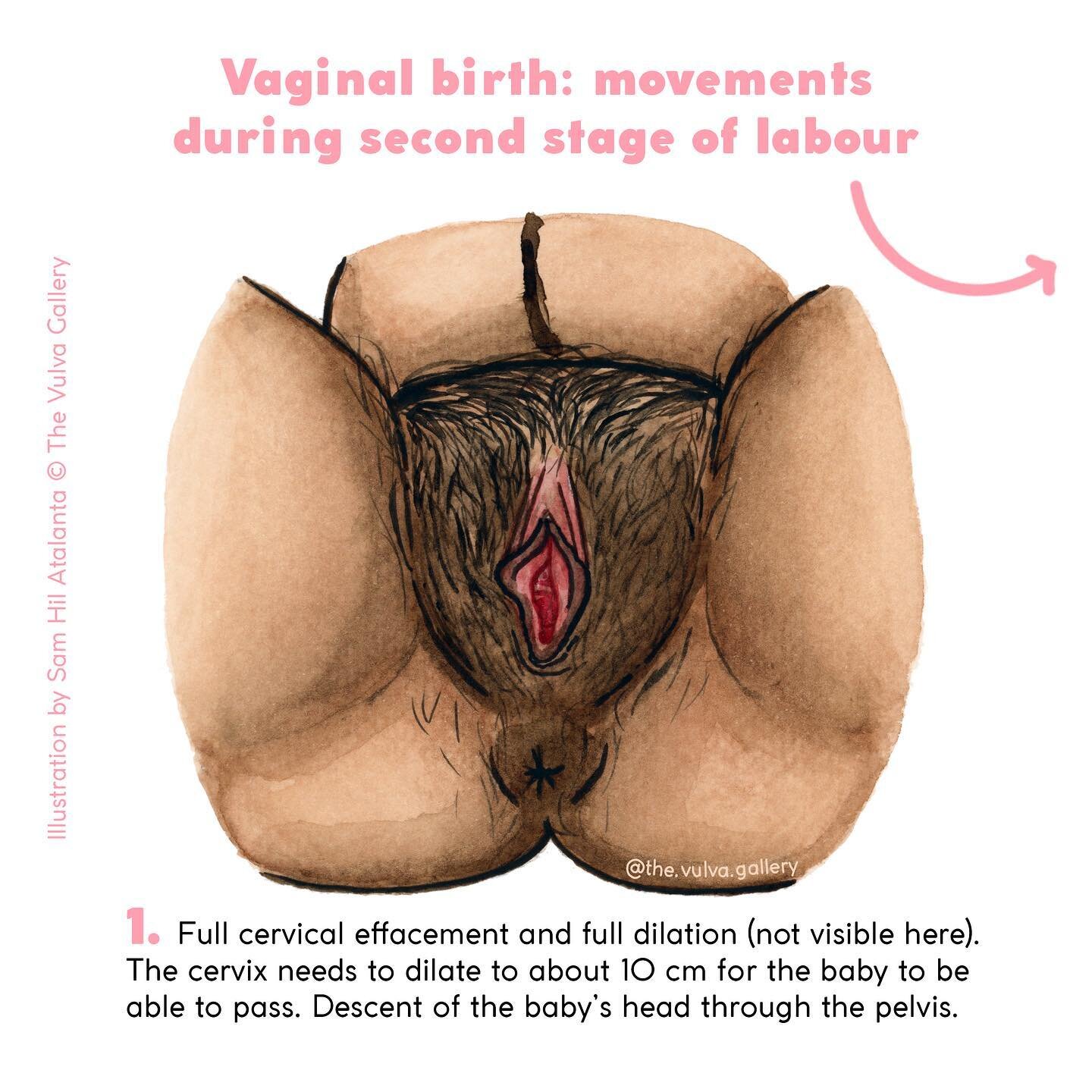 ✨ Let&rsquo;s talk about labour: How does a baby come out? What are the steps from uterus to birth? ✨

Above you can see what vaginal birth can look like. Please note that the way the body is positioned isn&rsquo;t necessarily lying down; you could i