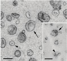 Exosomes Explained: The Regenerative Breakthrough Changing Aesthetic Treatments
