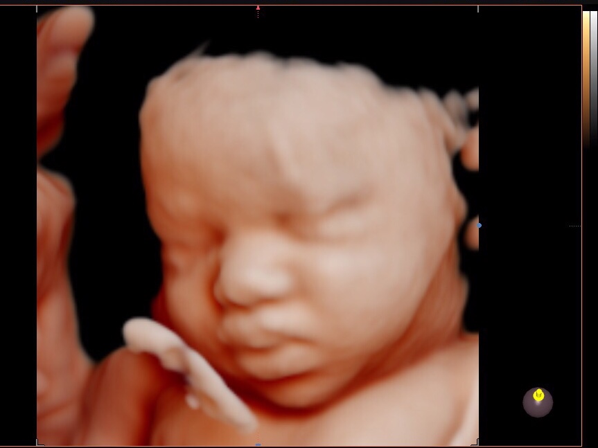 C2F2285C-C34A-4490-A2DB-7752B842AF1D.jpeg