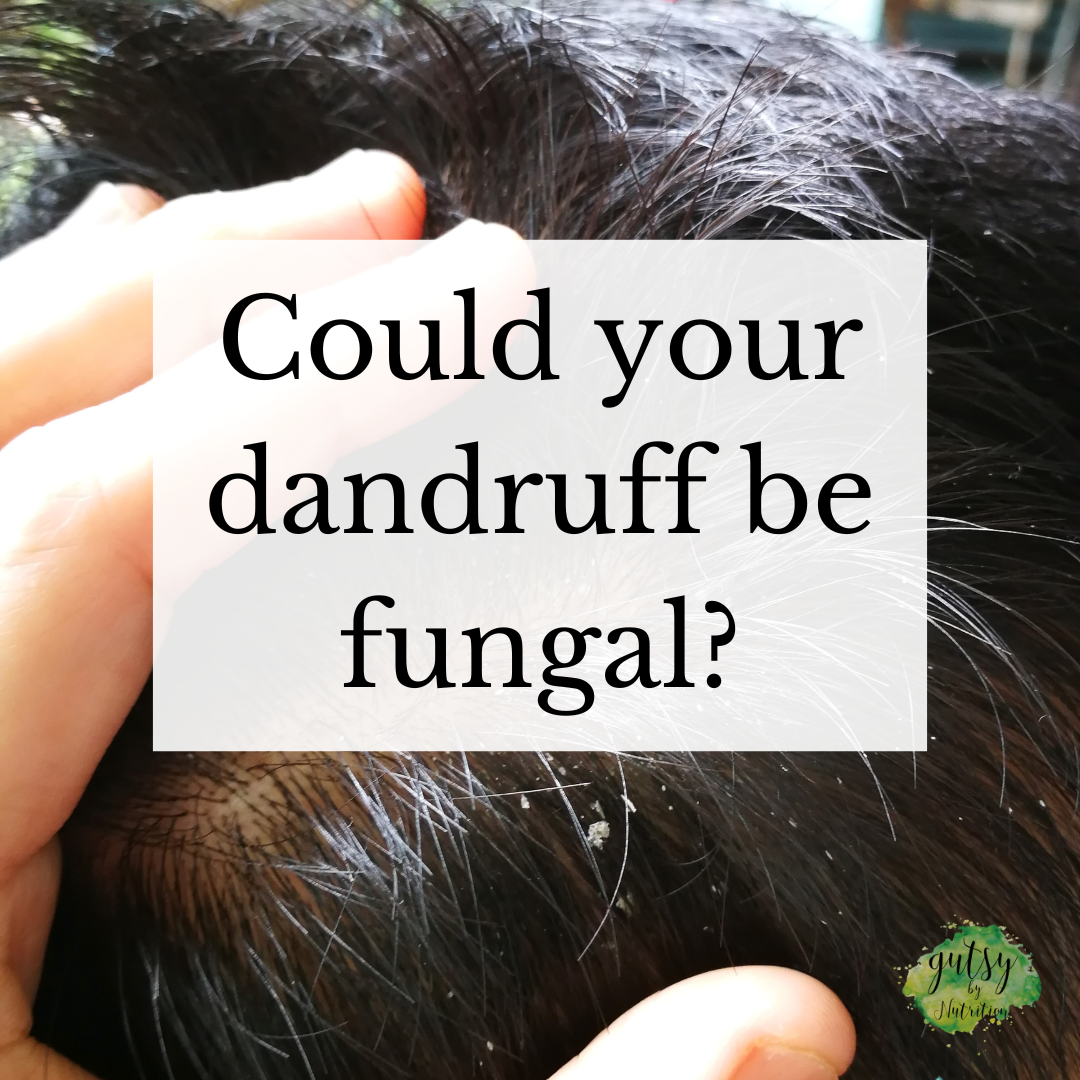 Is your dandruff fungal? — Gutsy By Nutrition Health & Wellness