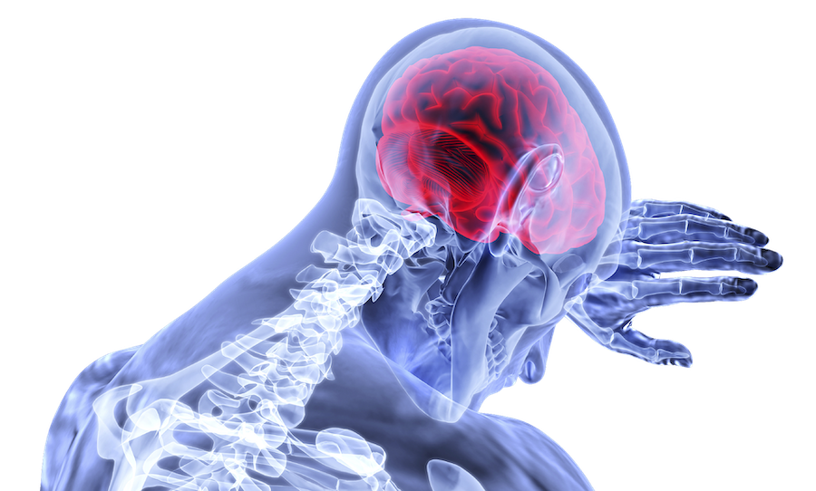 Improve your gut and brain health to reduce chronic pain