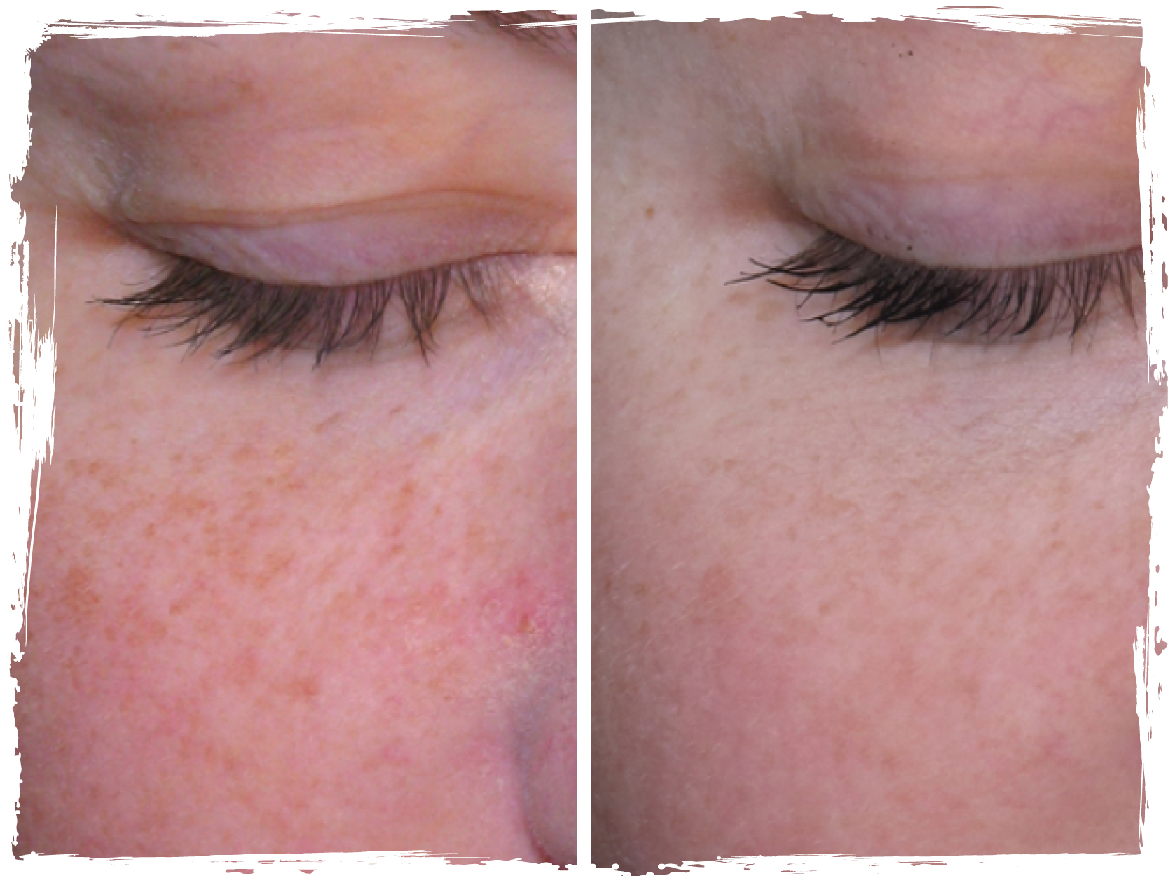 Before/After
