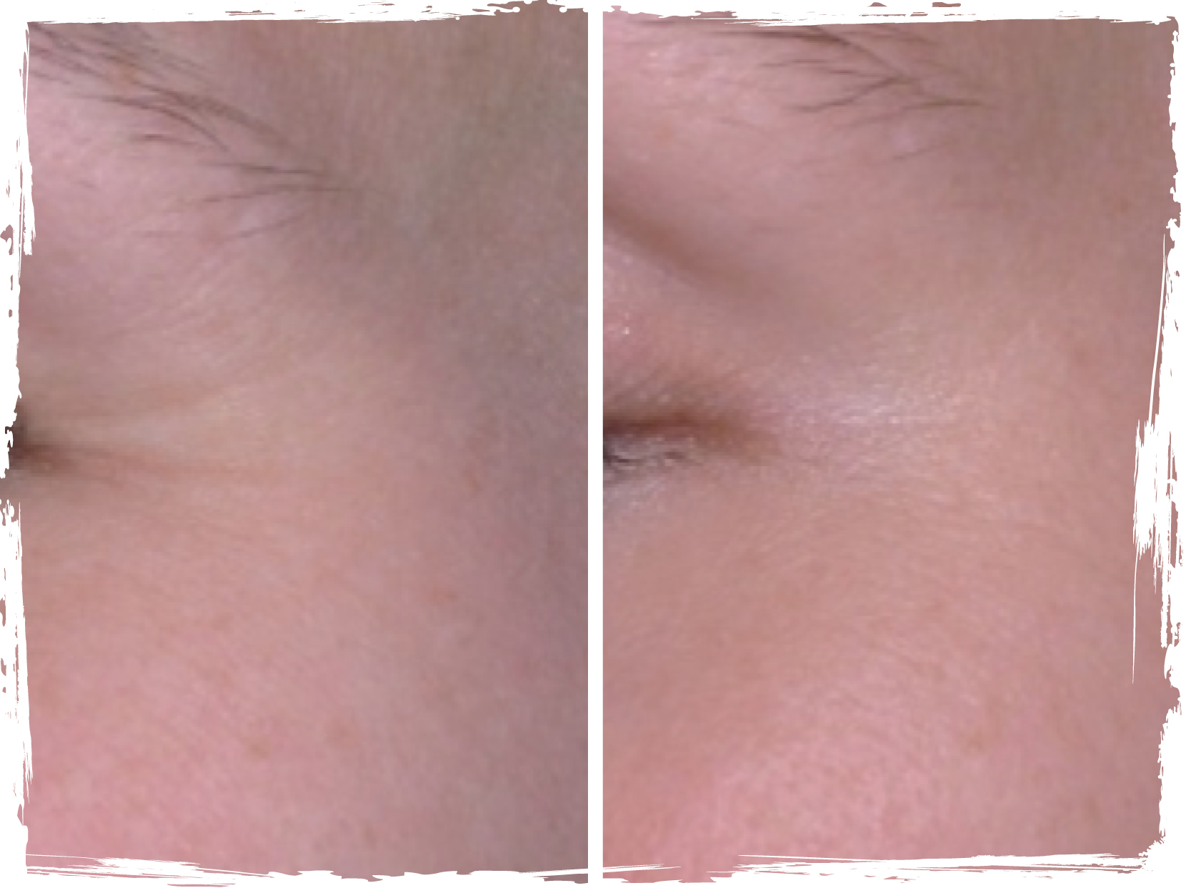 Before/After