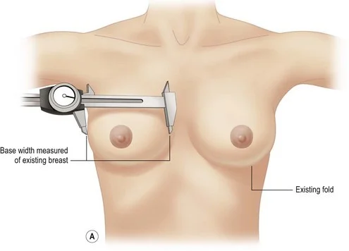 Base width diameter.jpg