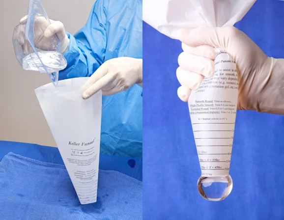 The Keller Funnel