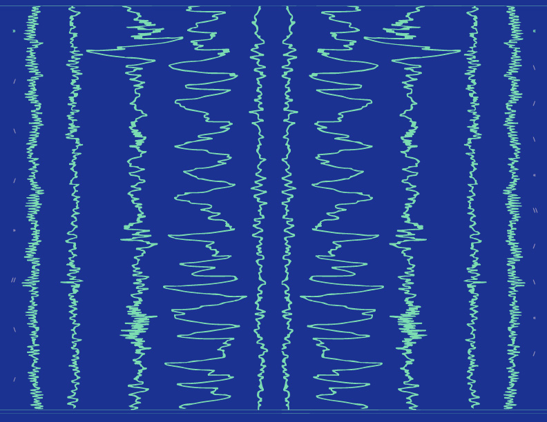 Pattern I made using the lines of an electroencephalogram (EEG) test of natural brainwave patterns during the different cycles of sleep. 
