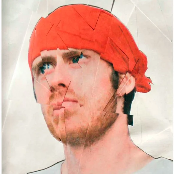 Dazed and Concussed: Head Injury and High Performance