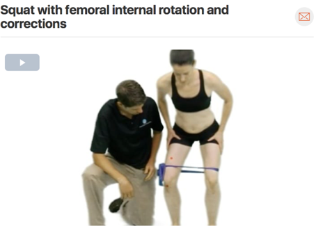 Therapeutic exercises chosen should always closely match treatment given in clinic. It is also important to correct the movement fault to prevent future irritation of the tissue source! This video shows the therapist correcting the patients squatting form. ( Click image to watch 1-2 minute video )