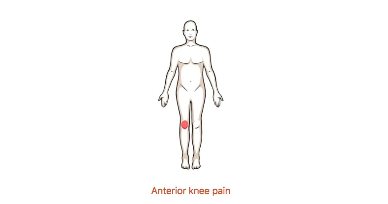 Anterior knee pain