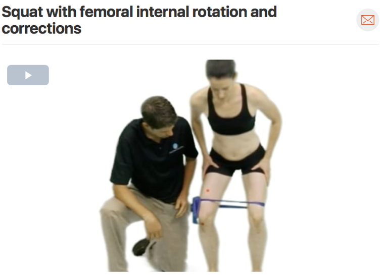 If you suspect patella femoral knee pain in your patient consider watching your patient squat and check for any movement faults. Commonly you will see your patient’s knees dive in (valgus), which we call the adduction/internal rotation movement faul…