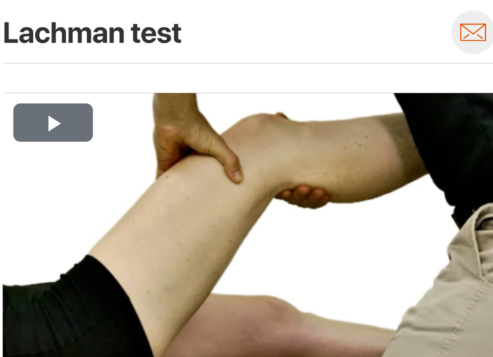 ·&nbsp;&nbsp;&nbsp;&nbsp;&nbsp; As we all know, one test is not enough to completely rule in or rule out potential pathology; however, the specificity of the Lachman test (94) makes it an excellent test to help rule in ACL pathology! &nbsp;&nbsp;&nb…