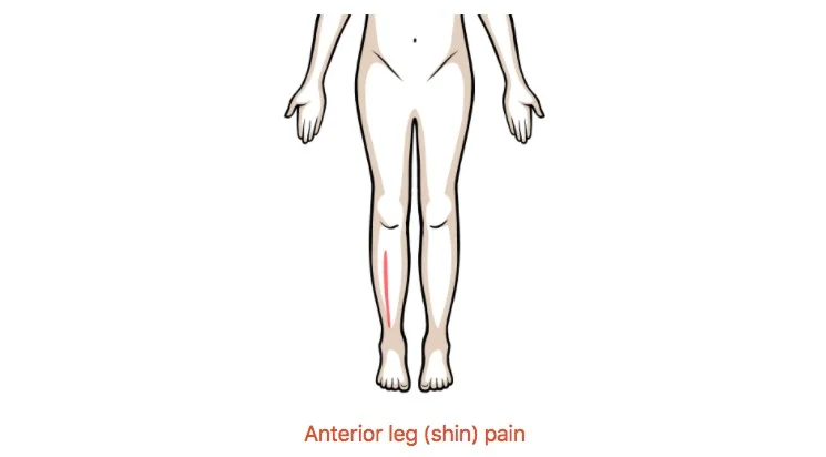 Clinical Pattern Recognition- Ankle & Foot Pain | Clinical Pattern ...