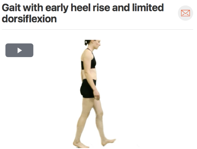 For lower extremity injuries it is important to watch how your patient walks, this can tell you a lot about their movement patterns. A common movement fault seen in people who sprain their ankle is a lack of dorsiflexion. While lack of dorsiflexion …