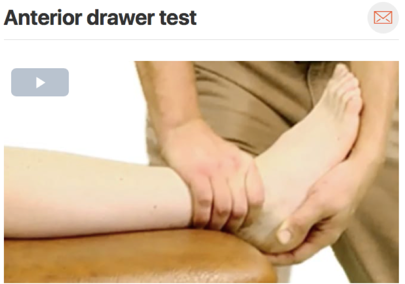 The anterior drawer test can be used to assess anterior talofibular ligament integrity. This tendon is commonly injured with lateral ankle sprains. Make sure to assess the uninvolved side before assessing the involved side in order to see what is “n…