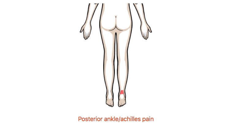 Posterior ankle/achilles pain