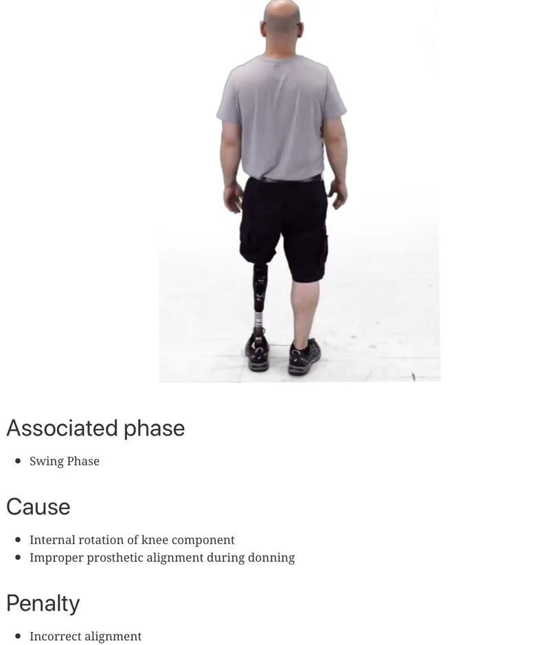 Gait App Update Prosthetic Gait Deviations is now available! — PhysioU