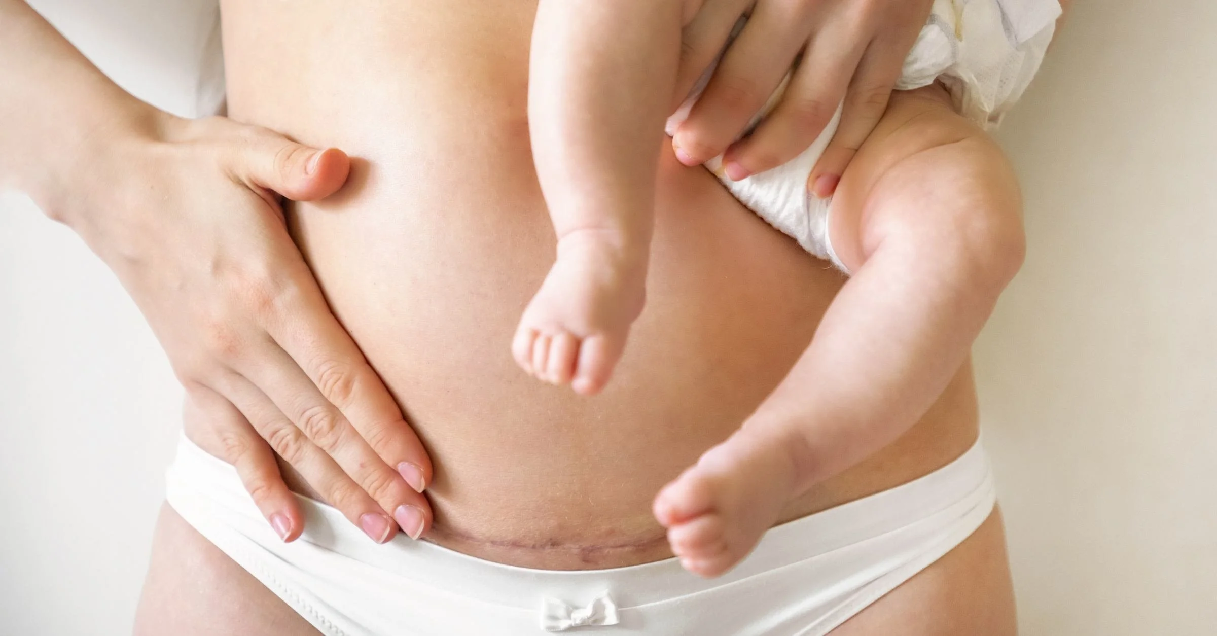 Considering a VBAC?...Doulas Are Essential