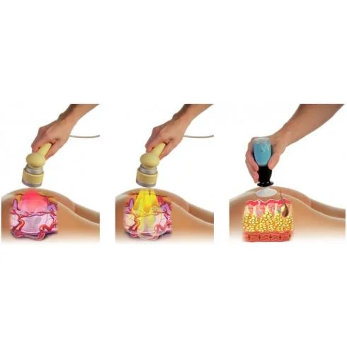 no needle meso anti celulitee.jpg