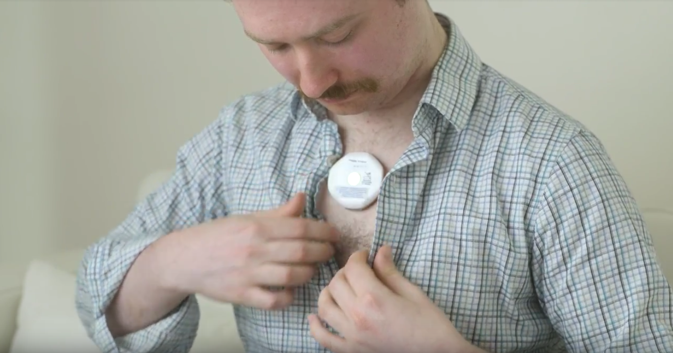  User applies the SKYE sensor 