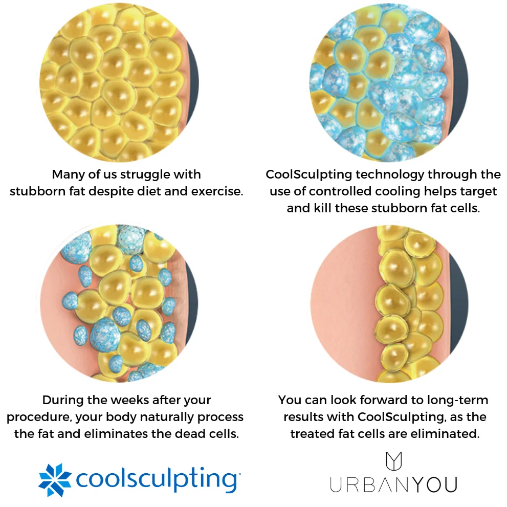1.3.19+CoolSculpt+Blog-1.jpg