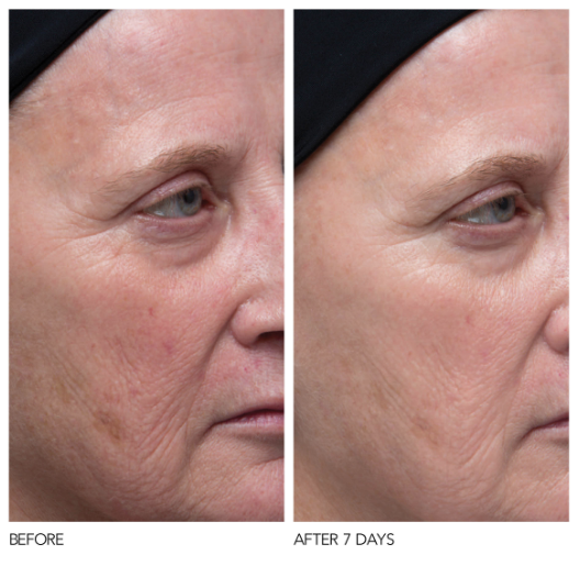 Vitamin C The best skincare ingredient ever? — Urban You Modern