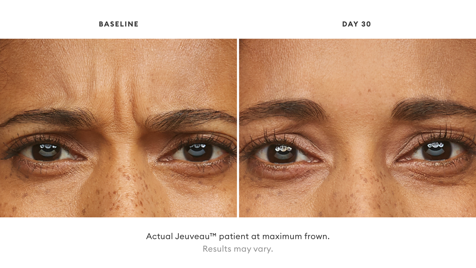 There's a #NEWTOX in town: Jeuveau™ — Urban You - Modern Beauty + Wellness There's a #NEWTOX in town: Jeuveau™ — Urban You - Modern Beauty + Wellness
