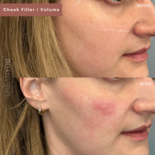 trends for loose skin after tirzepatide Weight Loss Treatments | Doctor-Led Clinics Loose Skin After Tirzepatide: Causes,