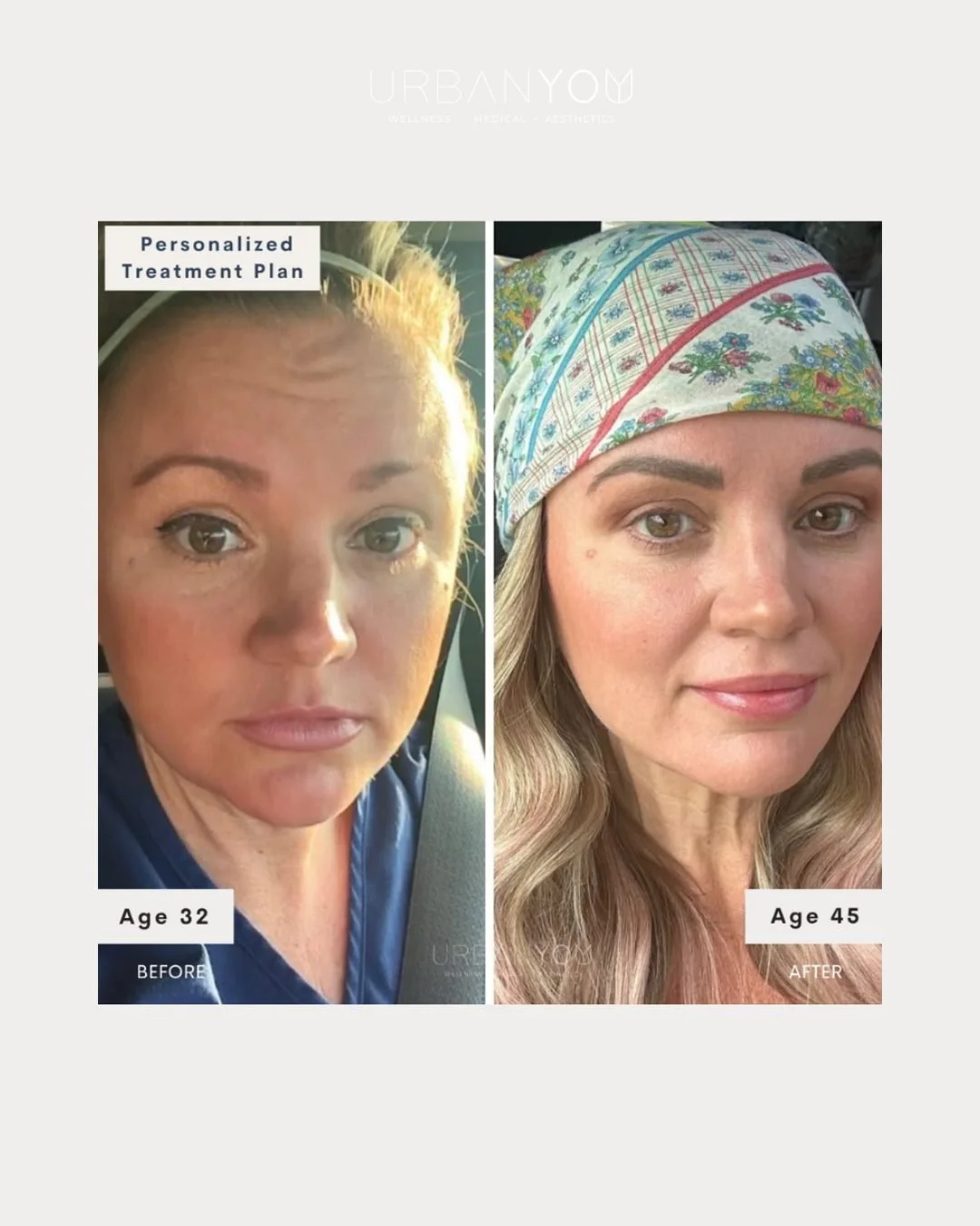 Resolutions fade.
Plans transform. ✨

Make 2026 the year you invest in long-term skin, wellness, and full-body rejuvenation &mdash; with expert guidance every step of the way.

Start the plan your future self will thank you for.

📞 Call (616) 570-02