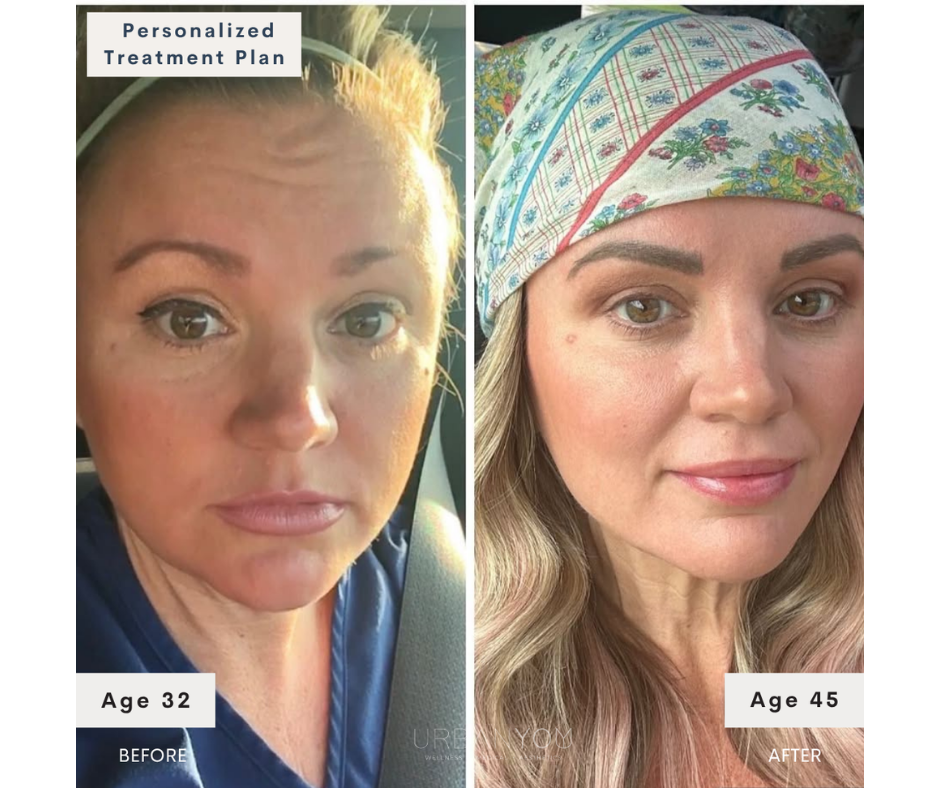 Side-by-side comparison of a woman before and after a personalized treatment plan. The before photo shows a 32-year-old woman with mature skin, and the after photo shows a 45-year-old woman with smoother, more radiant skin, wearing a colorful headscarf.